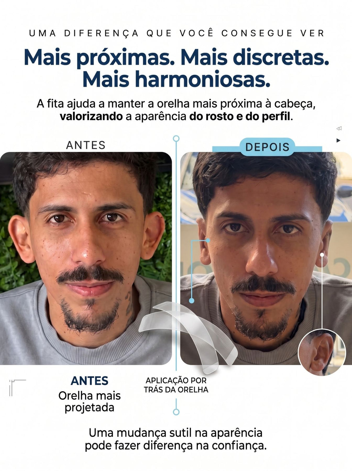 Adesivo Estético para Orelha | Fita Dupla Face Transparente e Discreta Adulto & Criança