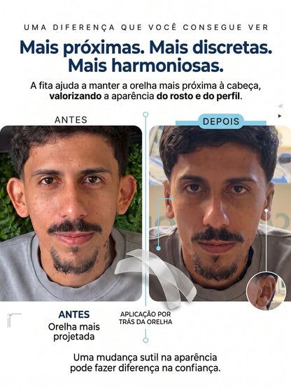 Adesivo Estético para Orelha | Fita Dupla Face Transparente e Discreta Adulto & Criança