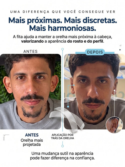 Adesivo Estético para Orelha | Fita Dupla Face Transparente e Discreta Adulto & Criança