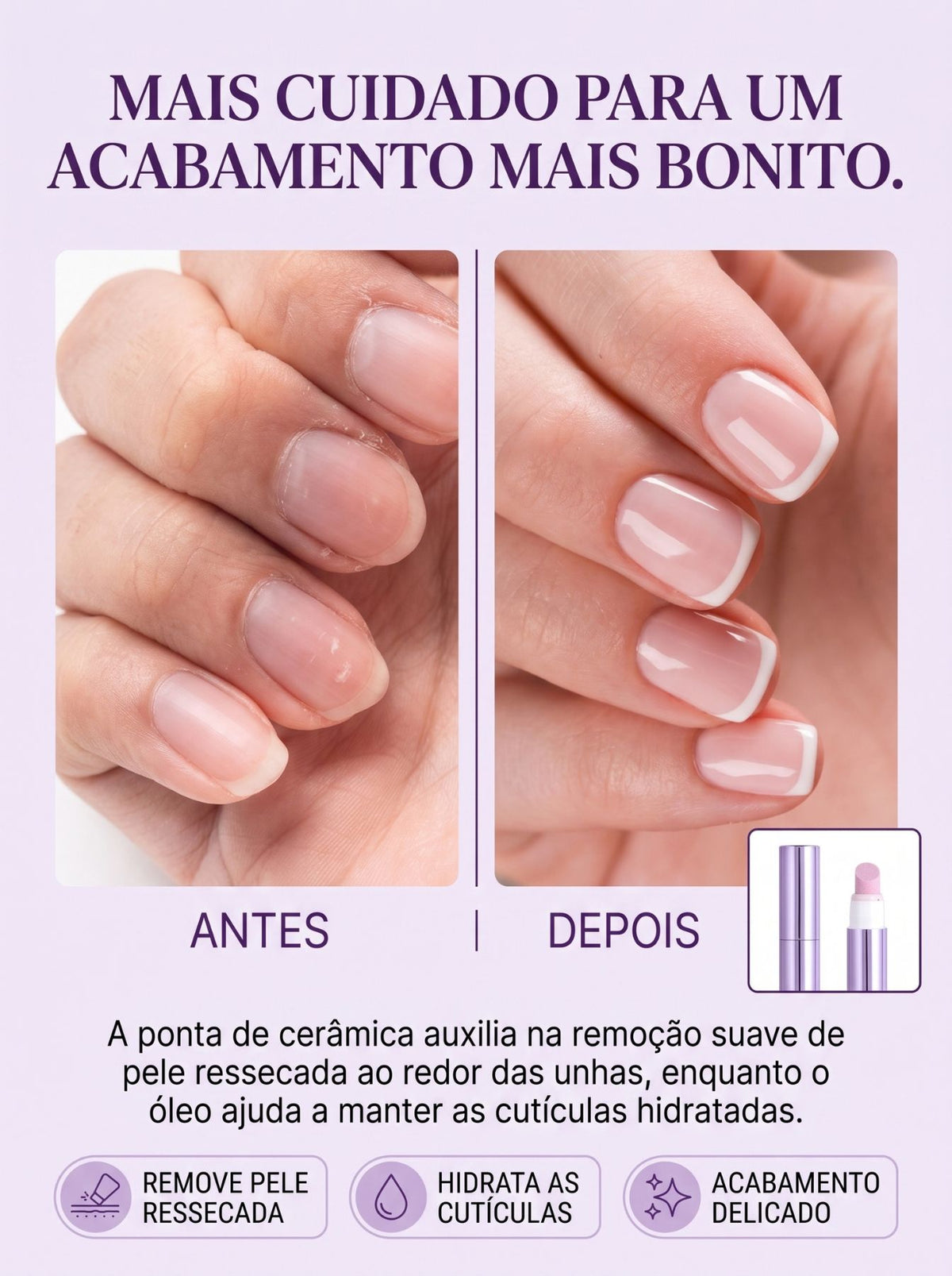 Caneta de Óleo de Cutícula 3 em 1 | Ponta de Cerâmica e Fragrância Floral